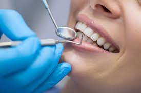 Lee más sobre el artículo ¿Cómo ser higienista dental en USA?